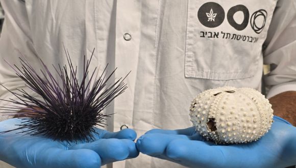 קיפוד הים Diadema setosum לפני (שמאל) ואחרי (ימין) התמותה