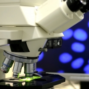 פרופ' יונה קיסרי נבחר לנשיא הארגון הישראלי לחקר הסרטן